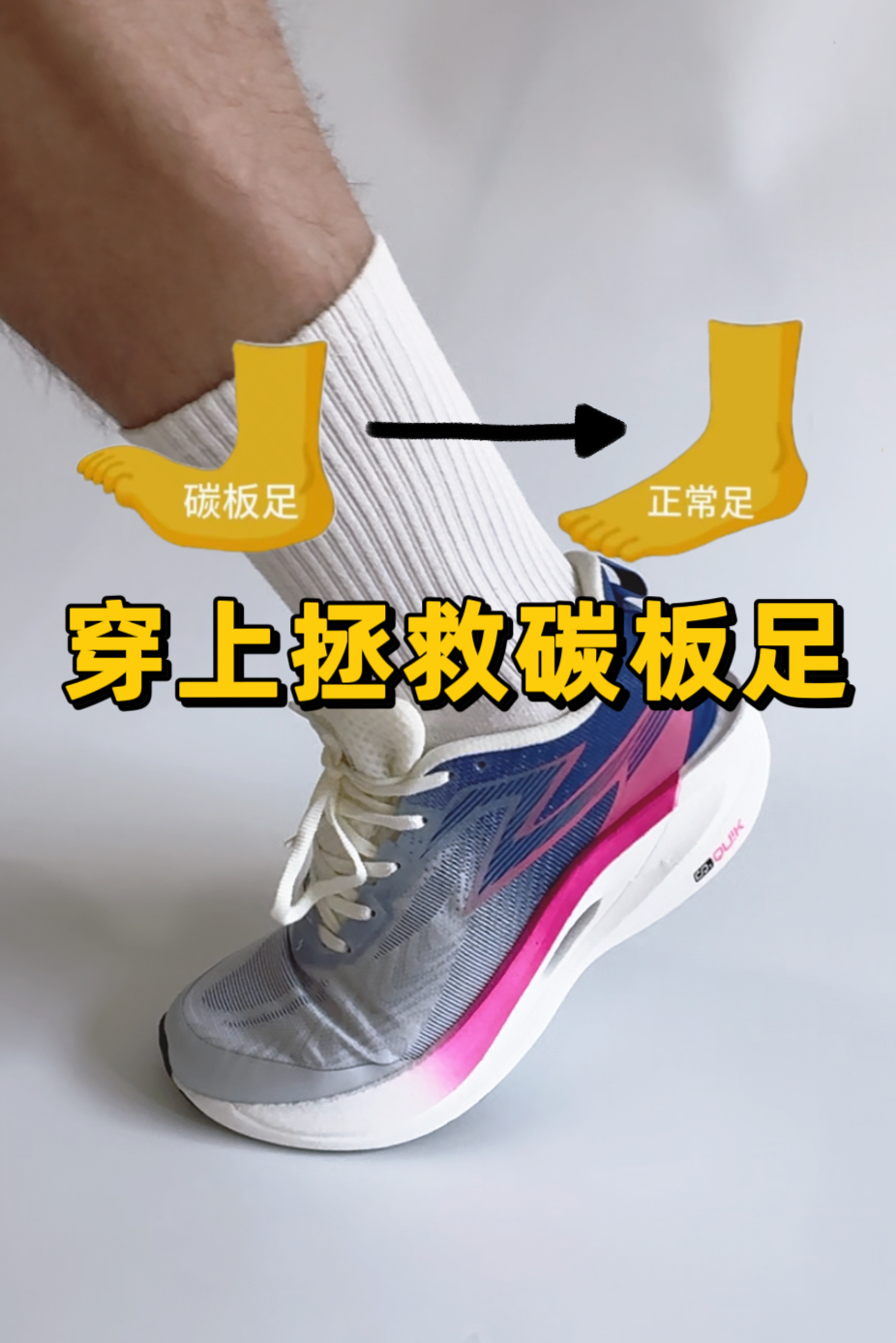 扁平足穿碳板鞋!会拥有足弓?