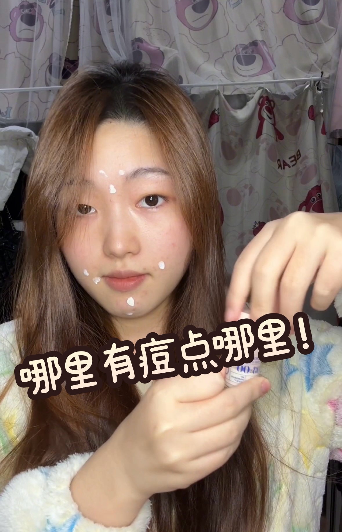 哪里有痘点哪里！