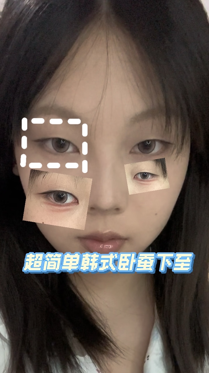 单眼皮韩式卧蚕下至💎
