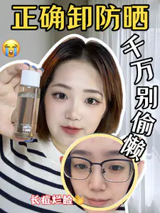夏天防晒闷痘?用它卸出毛孔垃圾!