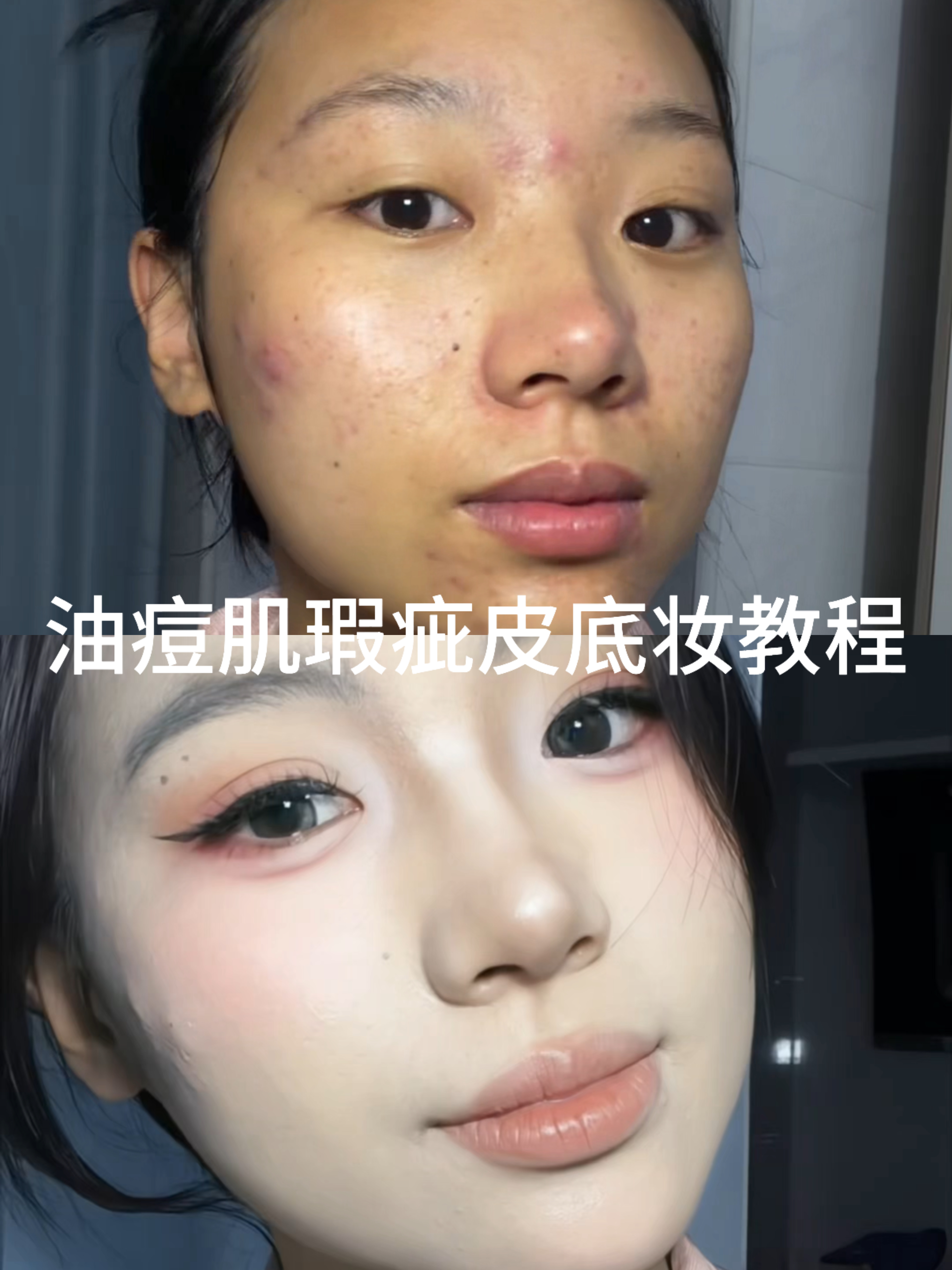 油痘肌瑕疵皮底妆怎么画