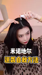 米诺地尔经验分享 秃头逆袭自救!