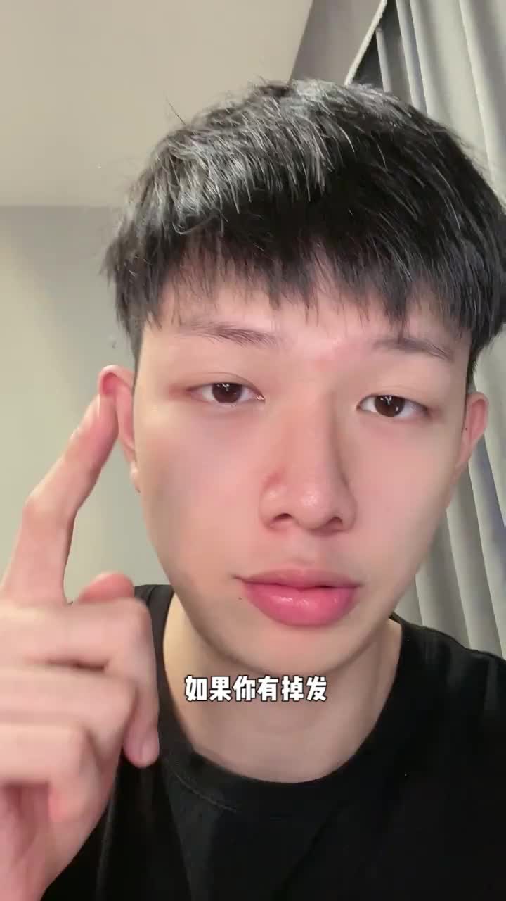 掉发人民的自我救赎‼️不看后悔‼️