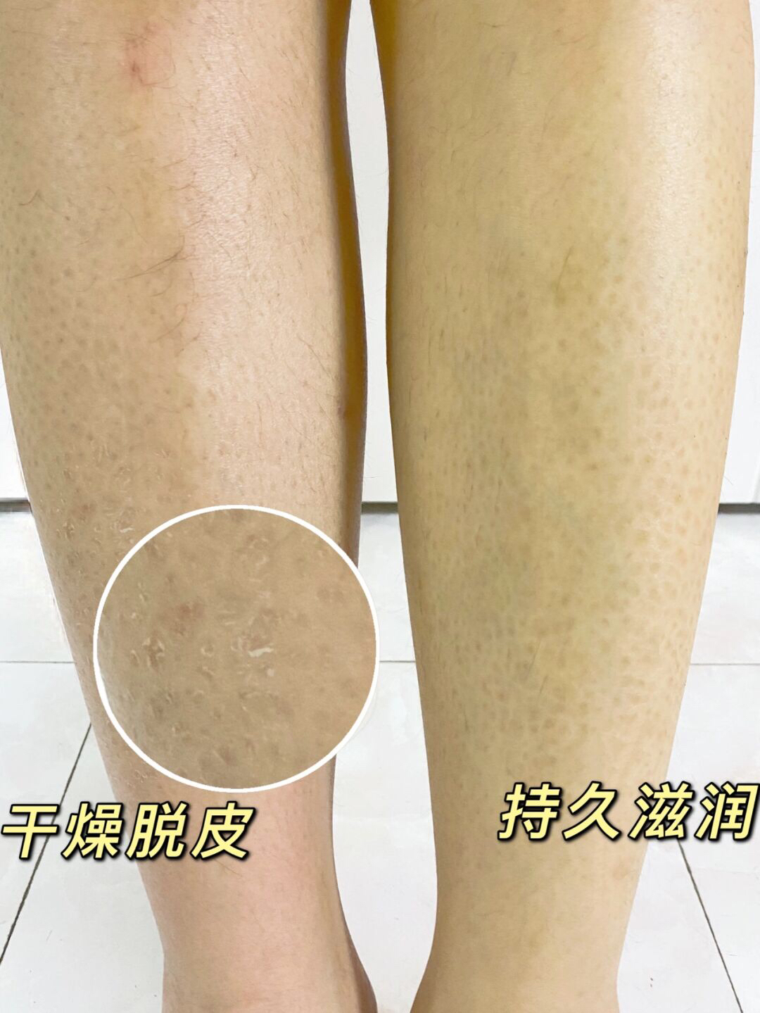 光滑小腿肌养成记，约会可以穿裙子啦！