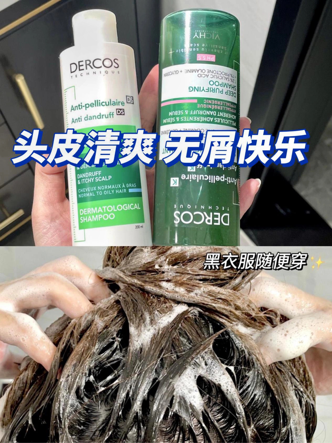 头屑头痒远离我！黑色衣服大胆穿！