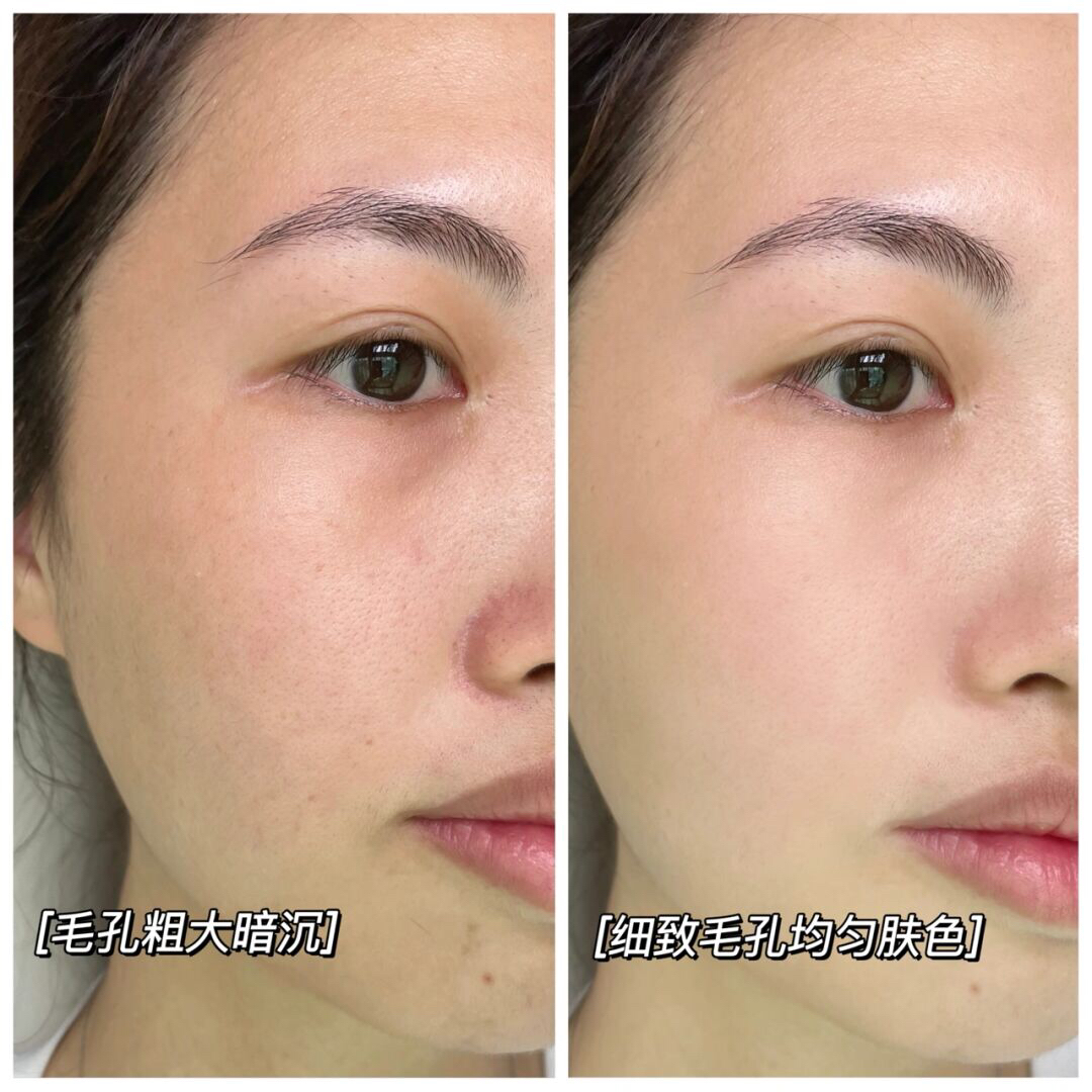 混油皮第一次遇到肉眼可见改善的水乳！