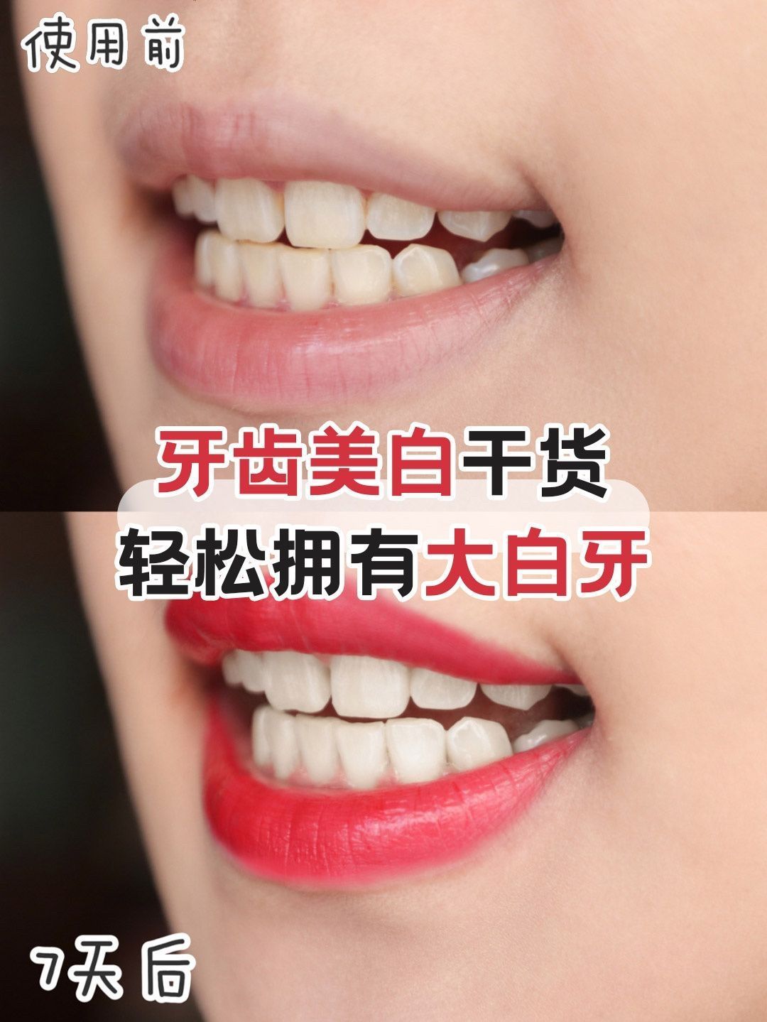 少女心高颜值牙膏分享🎀拥有一口自信大白牙