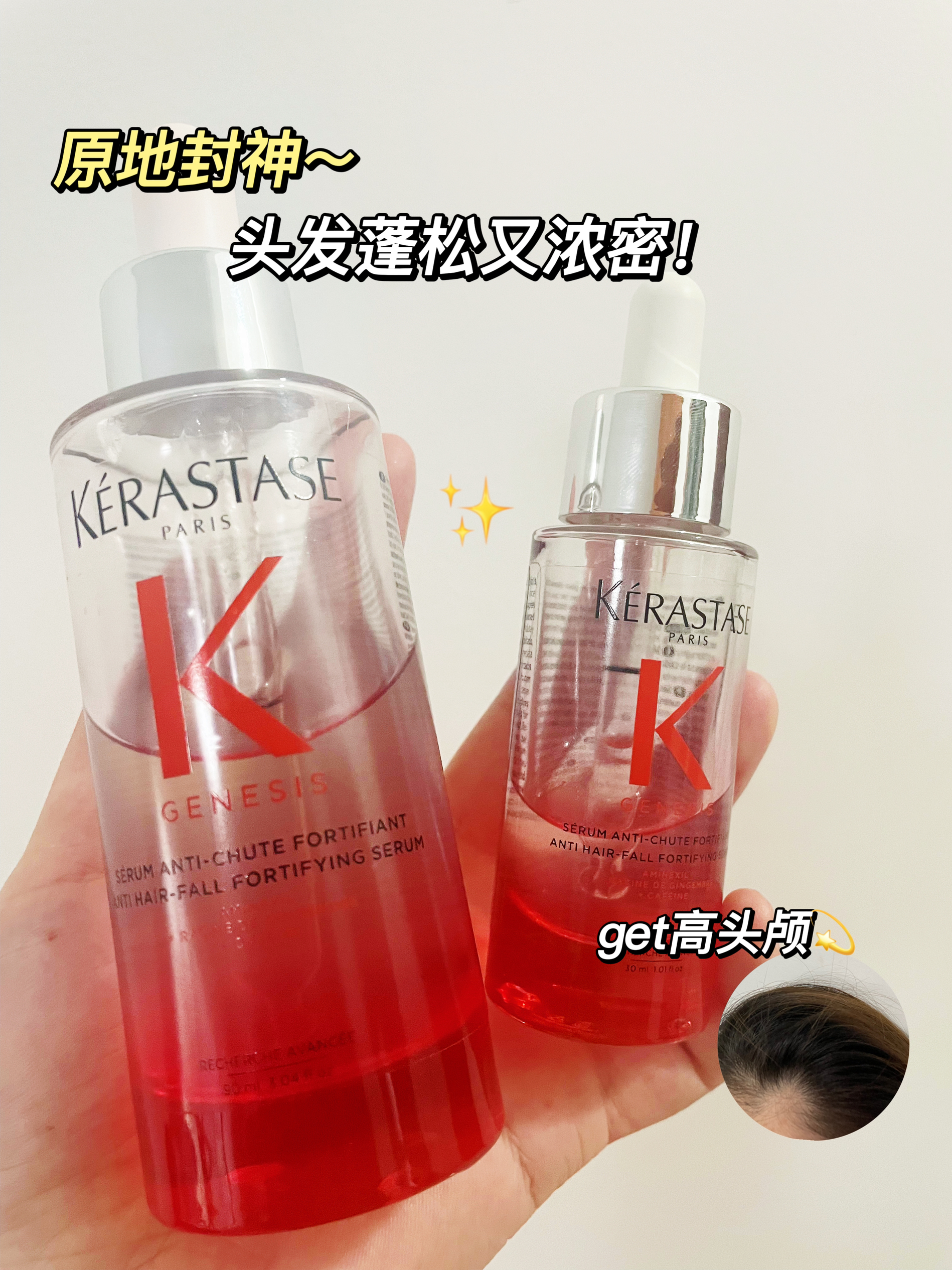 秃头少女逆袭了