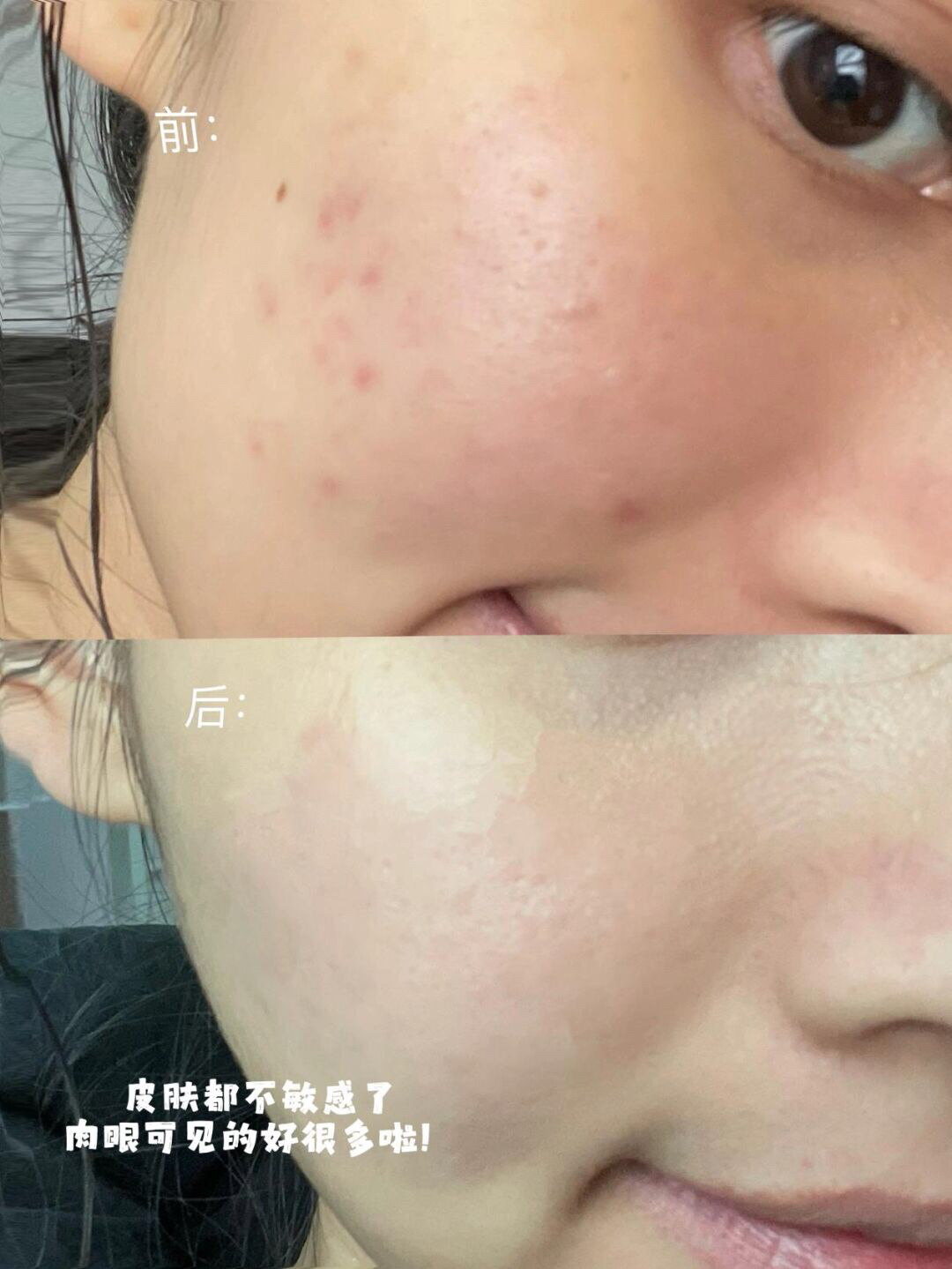 谁能对以油养肤不心动！还是大娘安利的