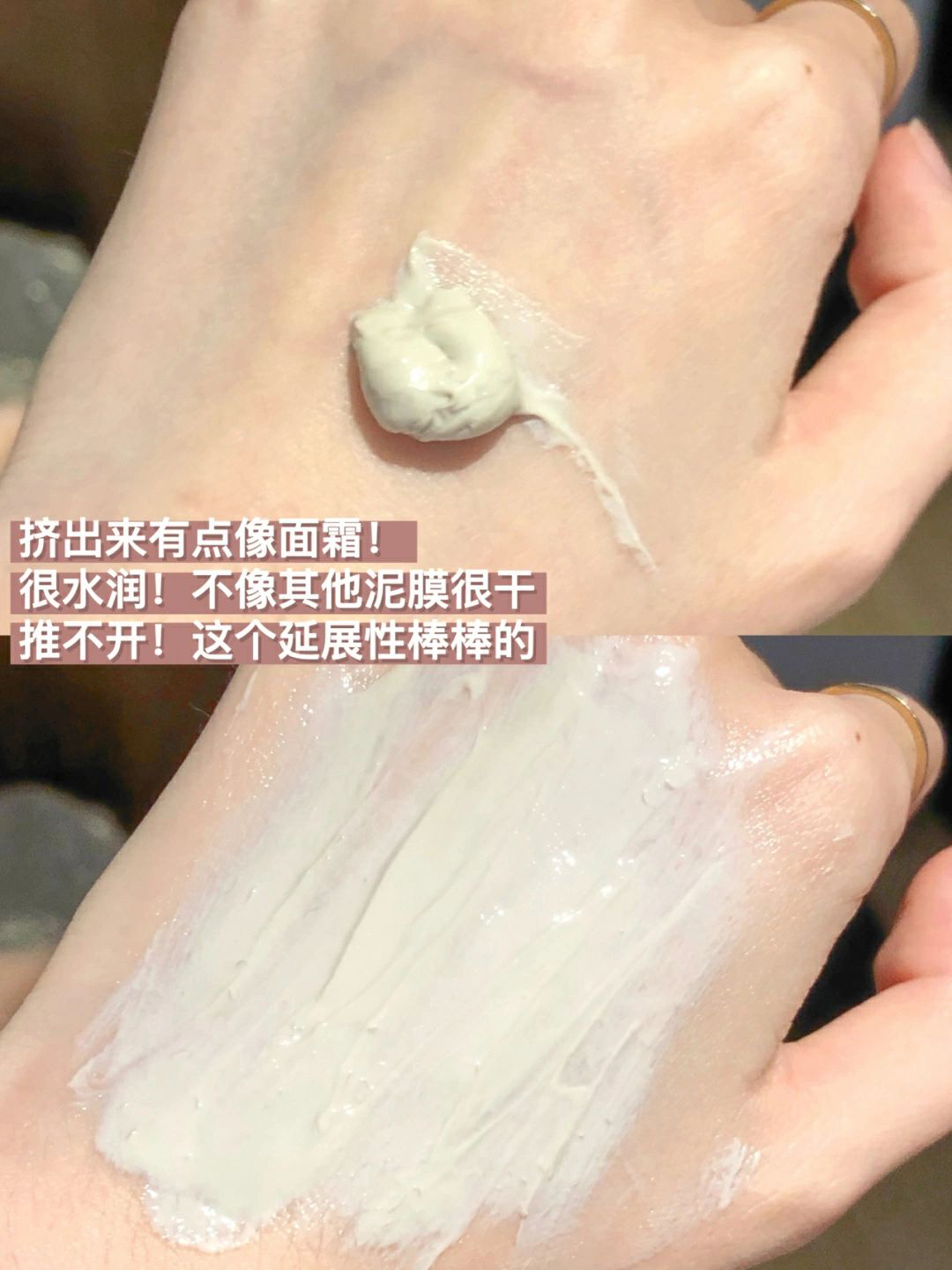 和20年黑头闭口分手！不怕原相机怼脸‼️