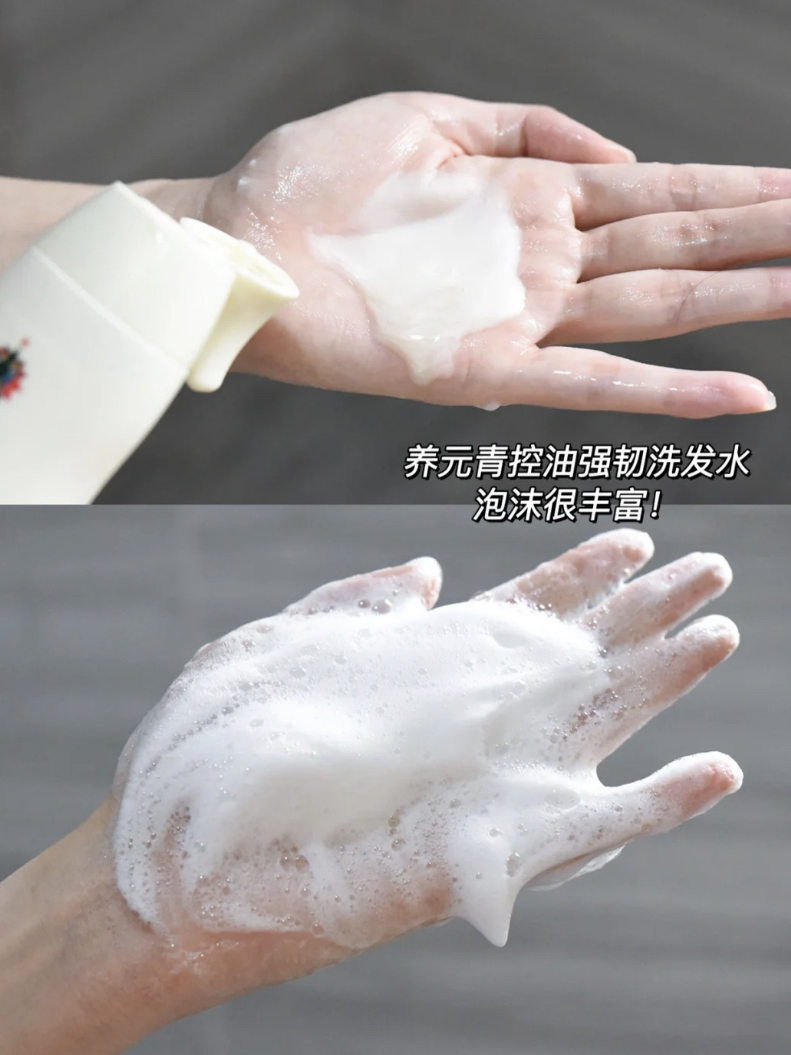 学会正确控油+防脱以后！我真的不秃了!