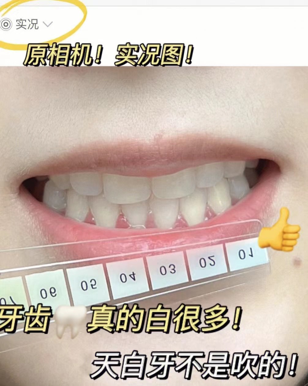 我服了…白的这么狠！不会还有大黄牙没用过吧