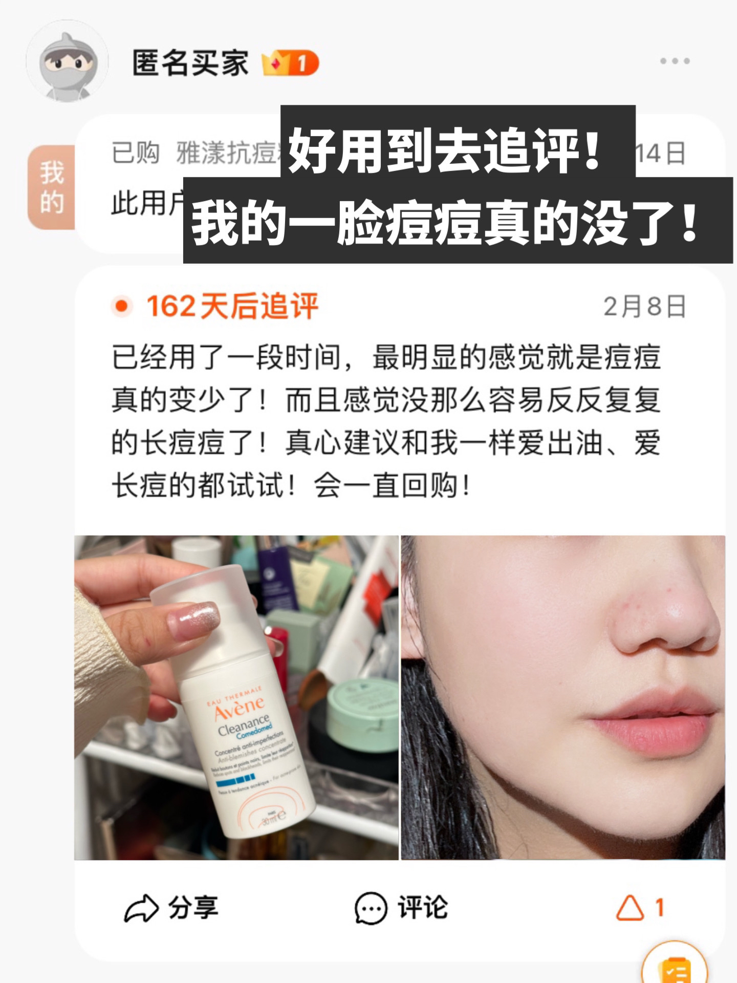 真的没用科技！用的是雅漾C位精华！