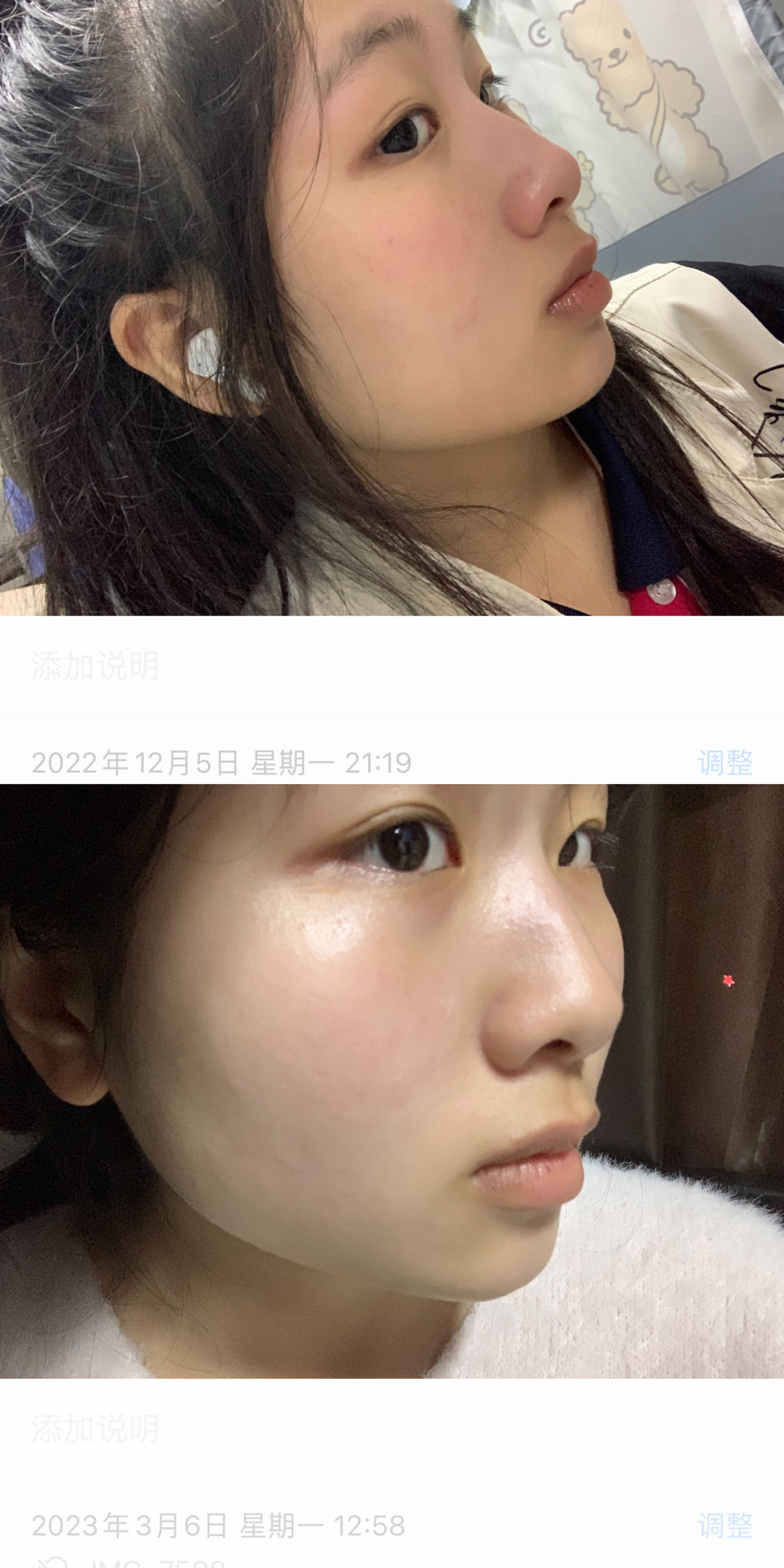 美白的维生素来啦！！！