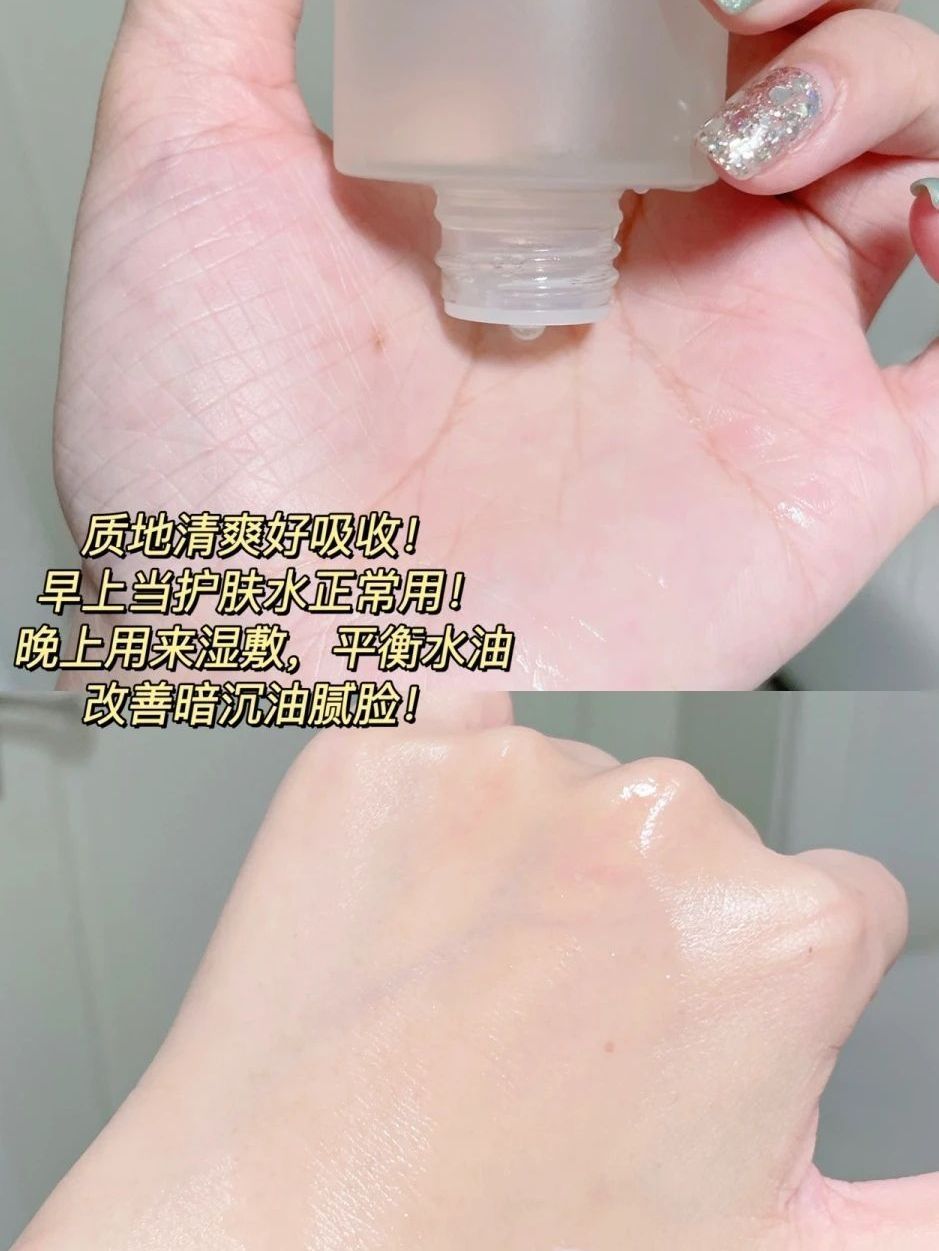 油痘肌快乐爽肤水！湿敷吃油太 🐮了！