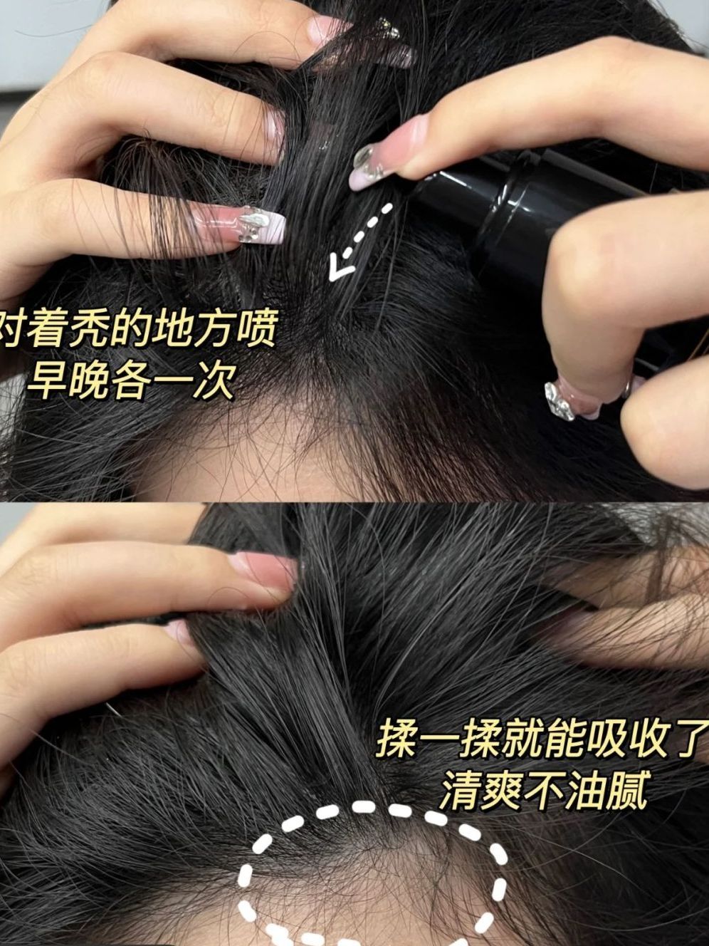秃头宝贝的神器组合｜秃头女孩们的救星来啦，别再为头发少emo了