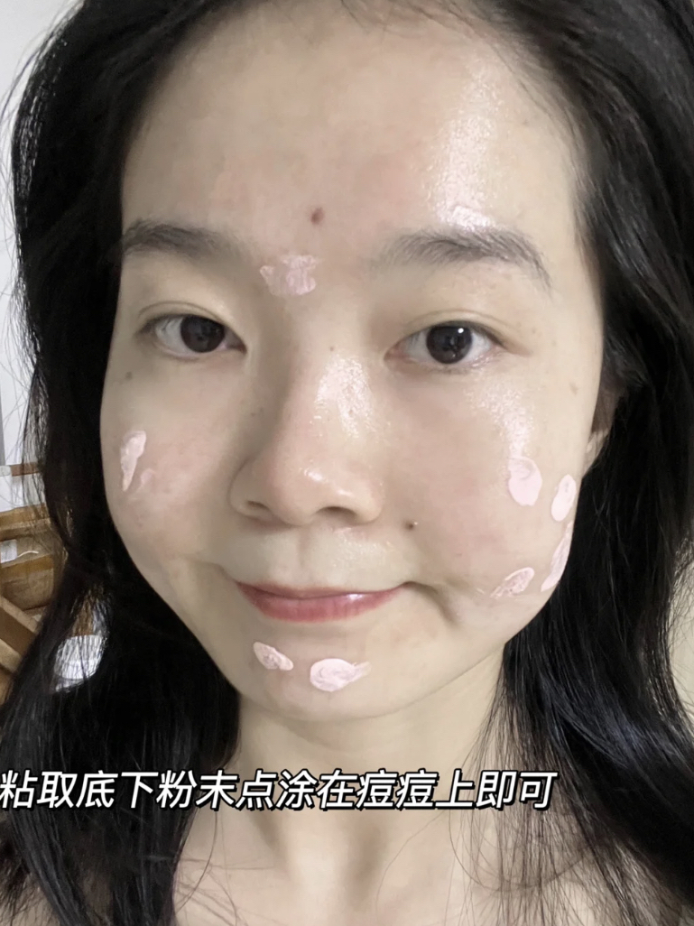 感谢小粉瓶！！让我和痘痘说拜拜