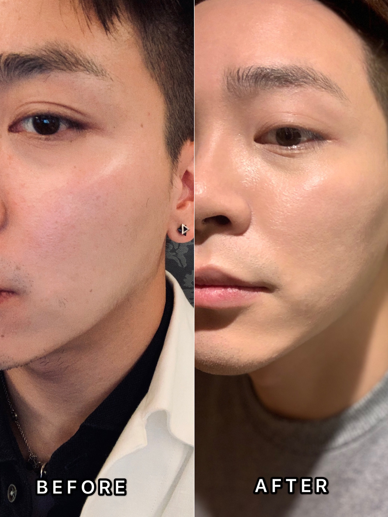 男生护肤|皮肤暗黄用这款面膜就对了!
