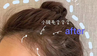 秃头拯救者