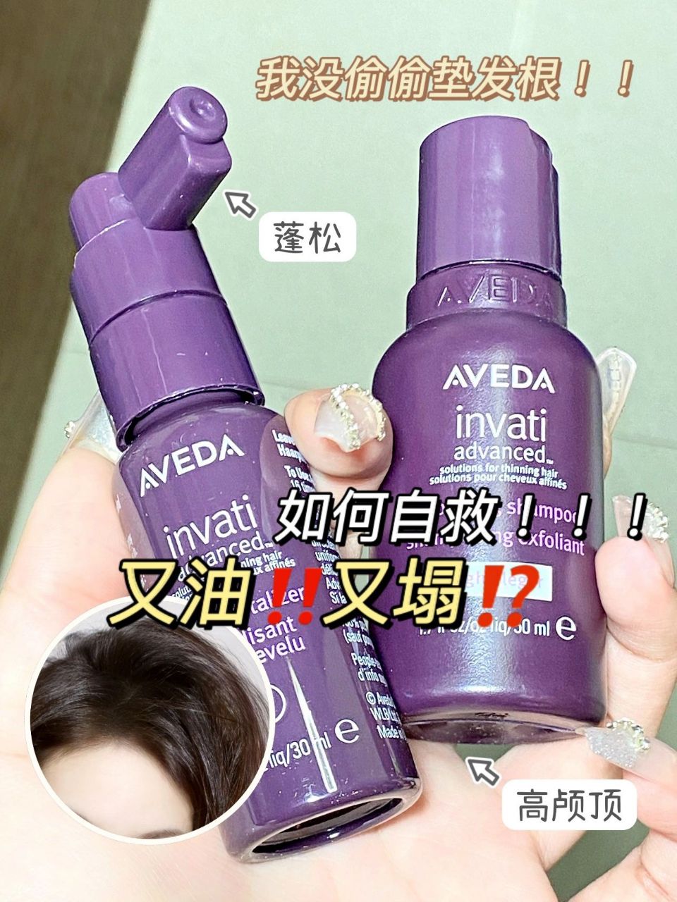头发太蓬松 他们以为我偷垫发根❗️|||