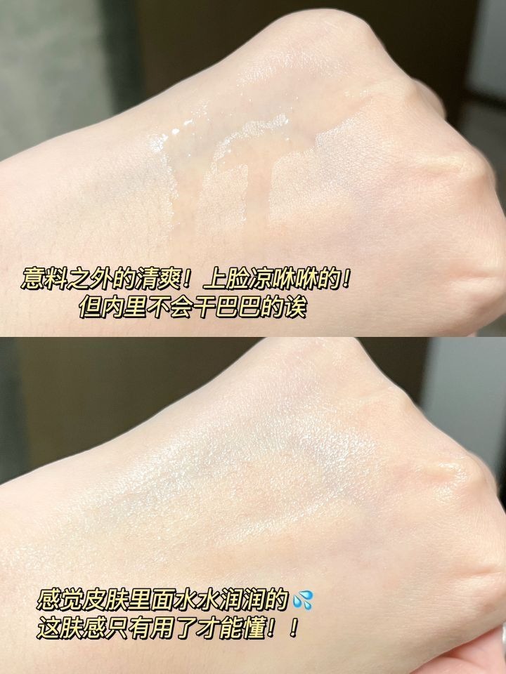 怪不得都说它好用！去闭口有两把刷子👍🏻！