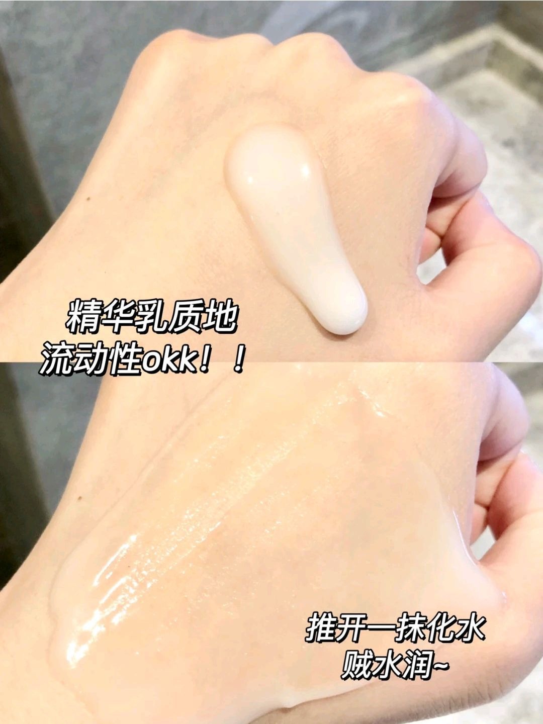 竟然把我的闭口黑头搞定了‼️油皮星人狂喜😍