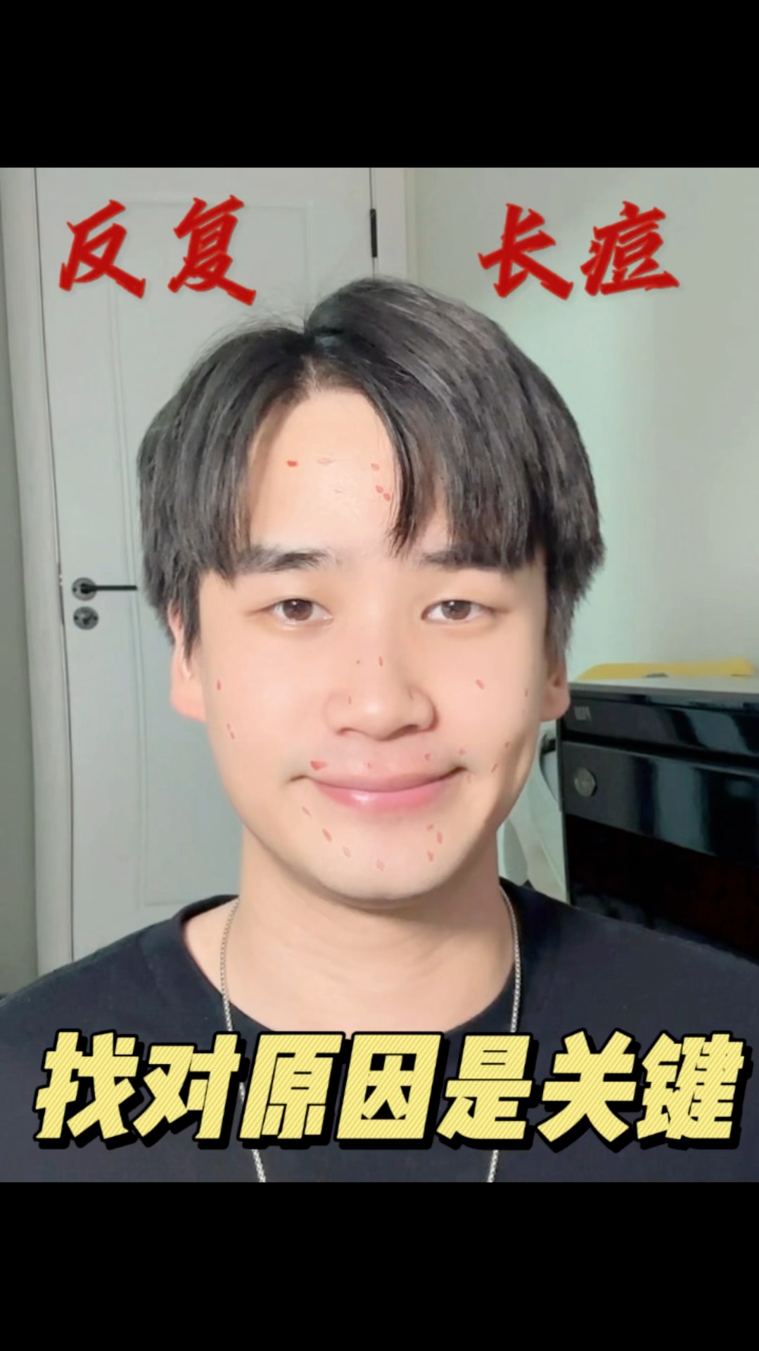 反复长痘‼️别急😤找对原因才能抗痘成功
