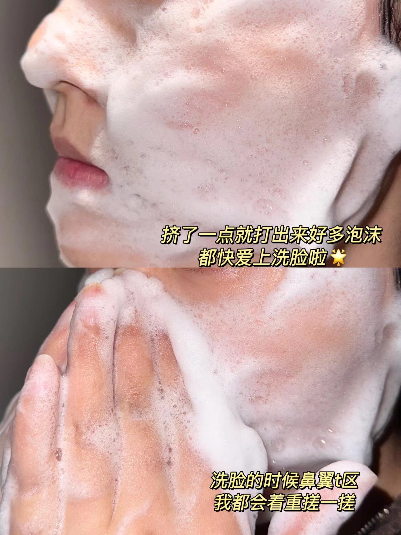 痘肌本命！皮肤干净到不敢相信！