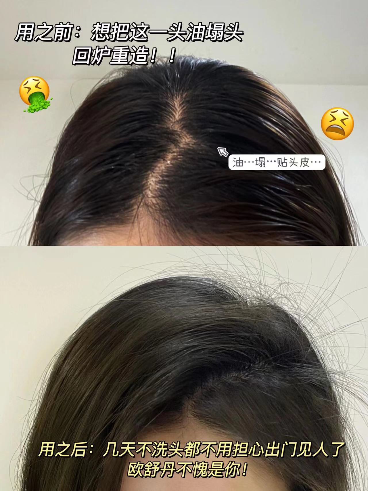 💆‍♀️💆洗头困难户🌸用清扬愿意天天洗头