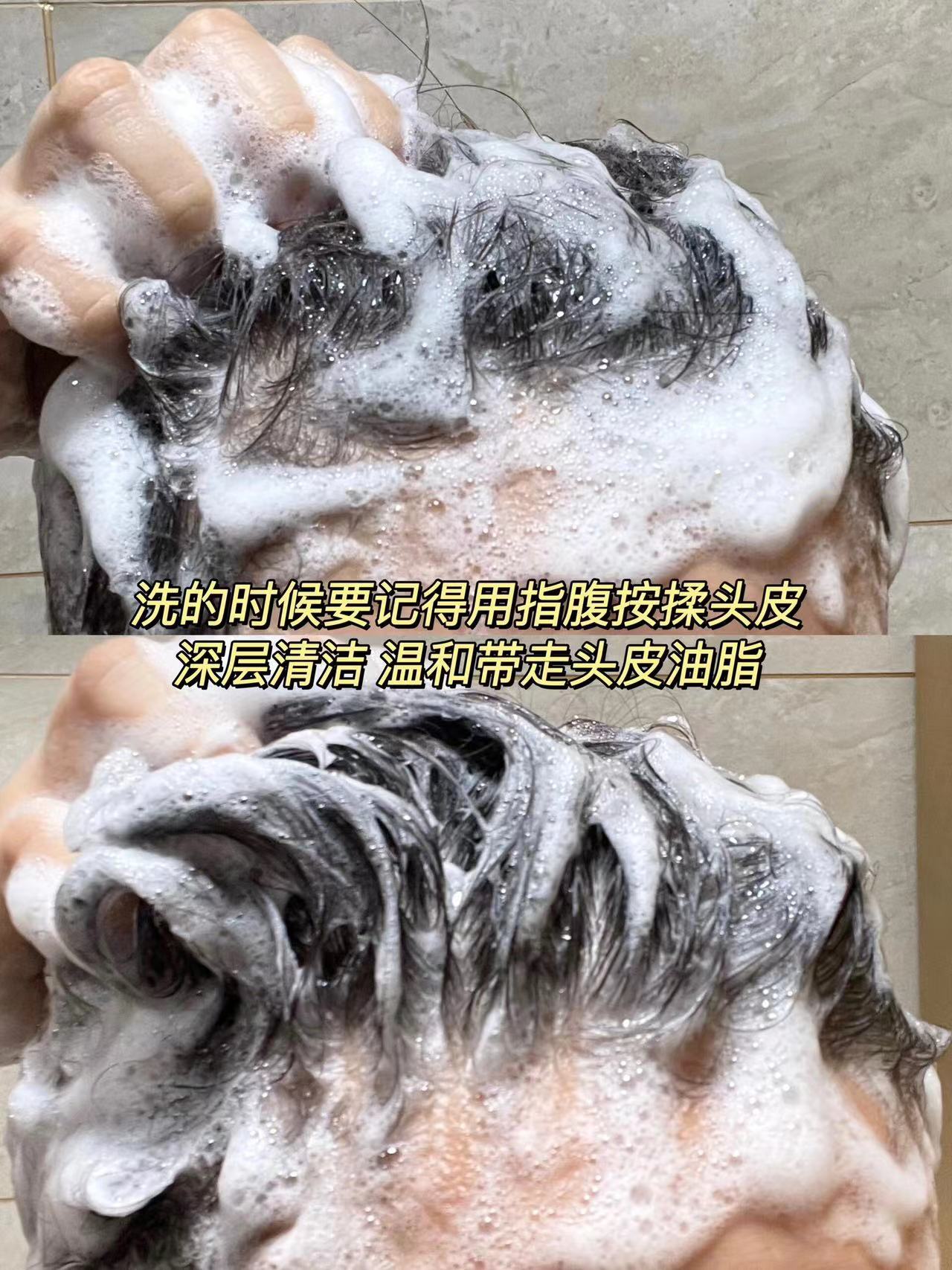 头皮终于干净了！原来以前都洗错头了…