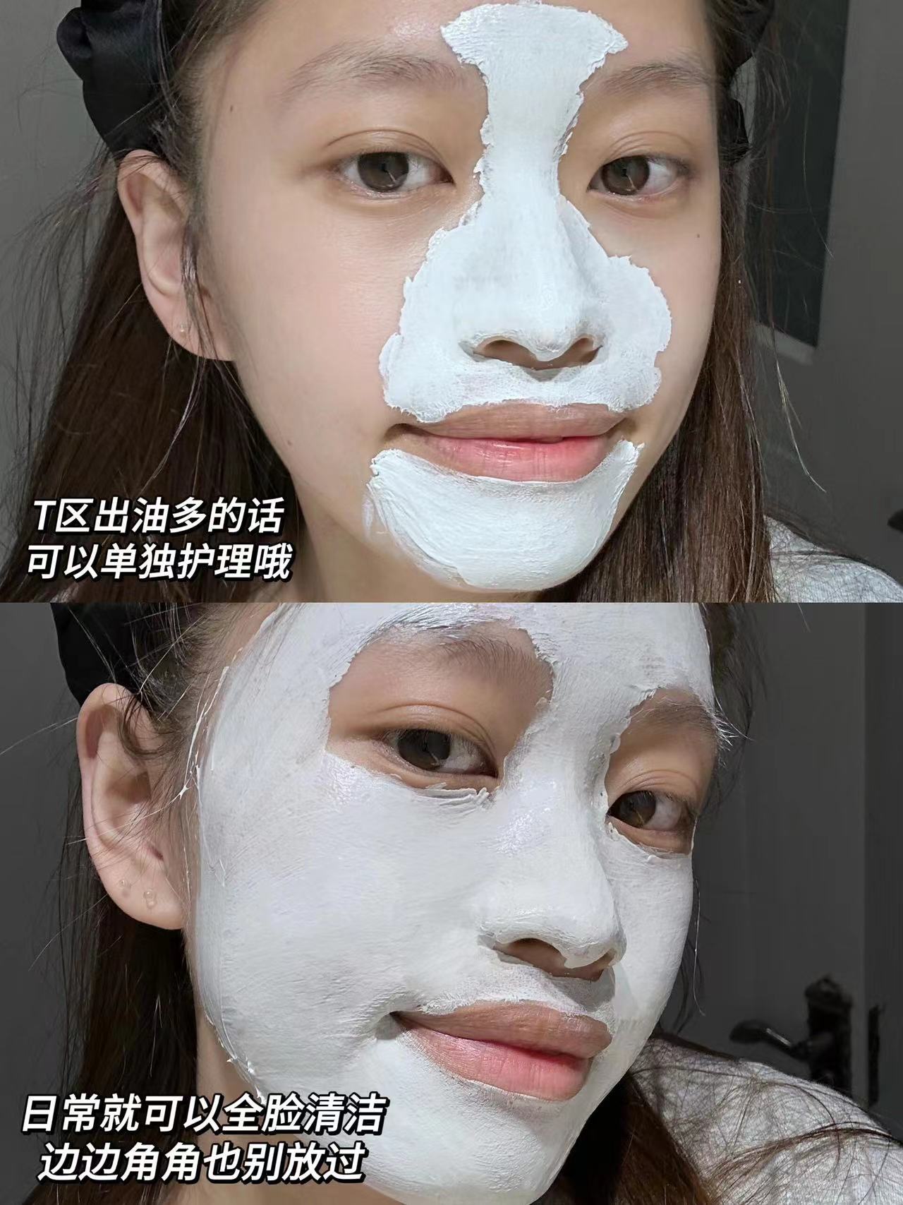 毛孔清洁大师🧹 真 当之无愧