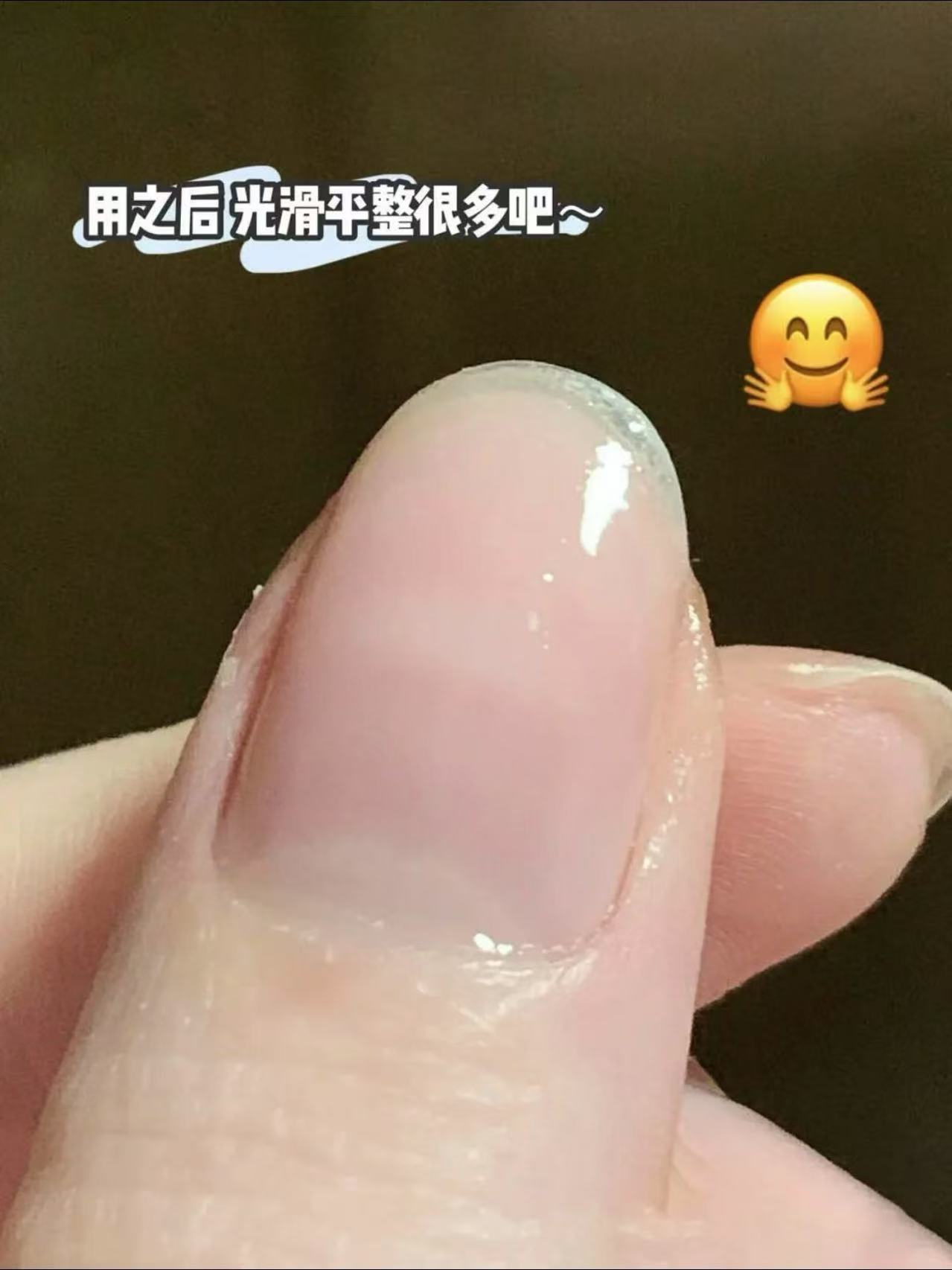 美甲党救星！这瓶甲液让我的脆甲重生了