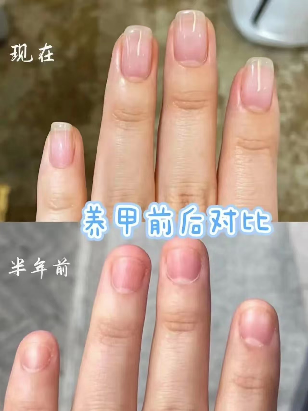 omg有了它‼️终于告别啃指甲😍