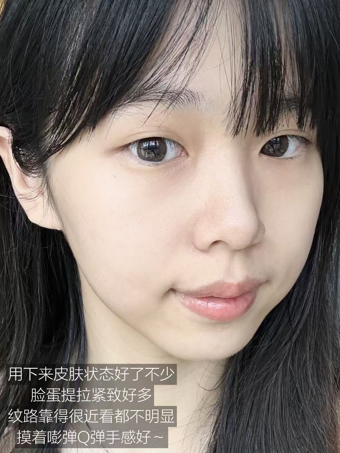 敏感肌天菜！芙丽芳丝护肤套装绝了