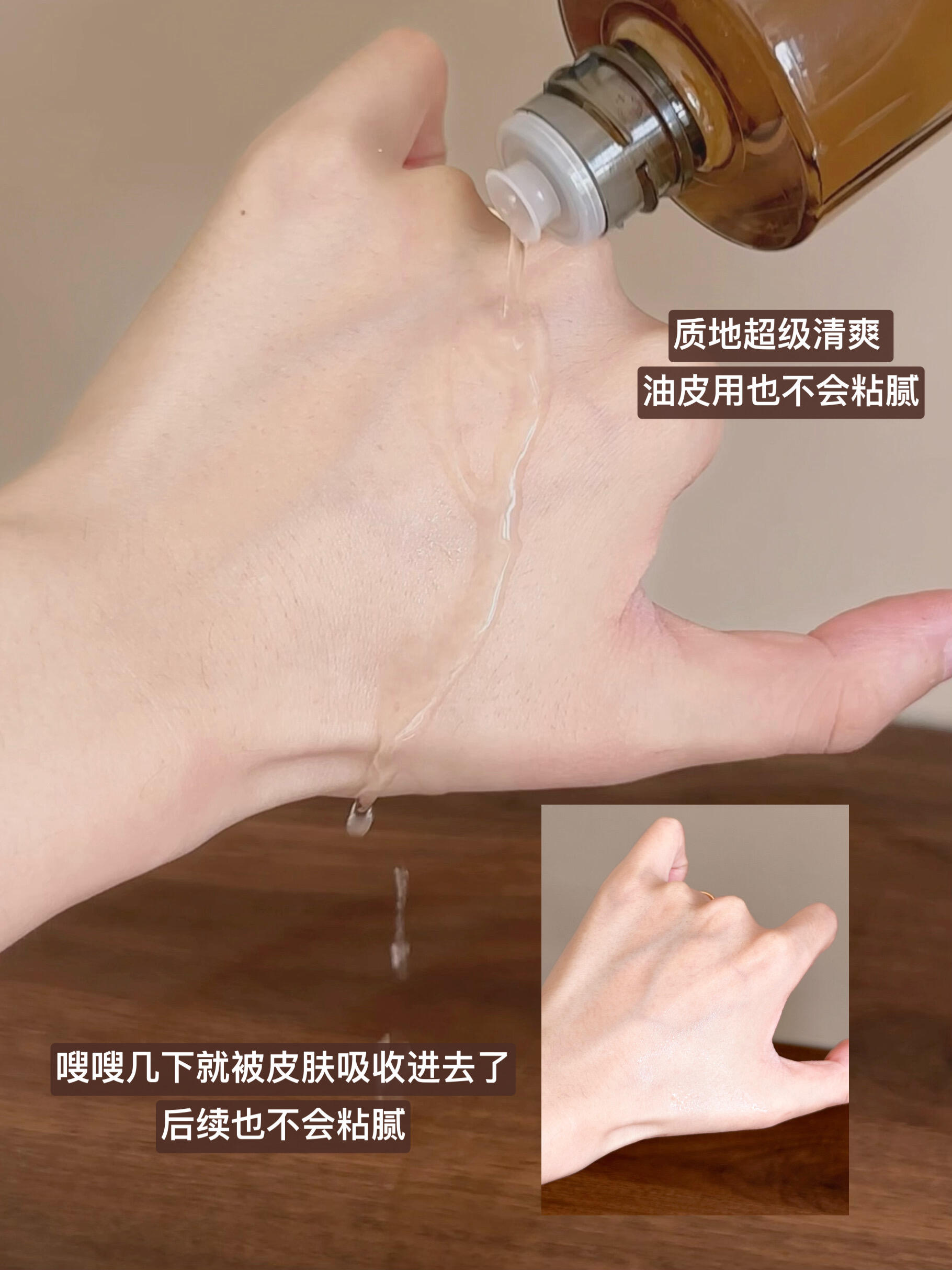 油糙皮的作弊神水！闭口粉刺全没了