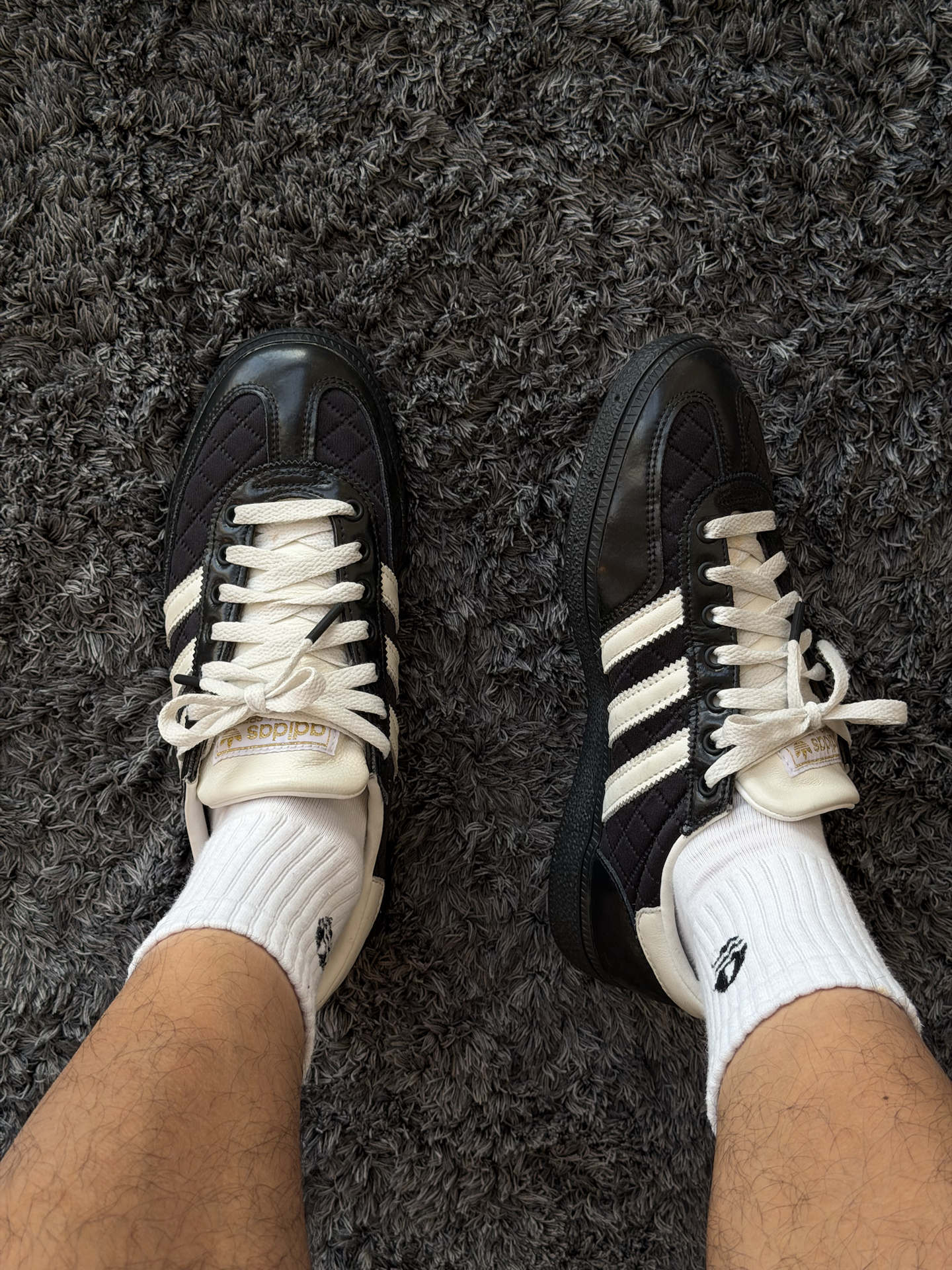 adidas黑色德训鞋的清爽搭配