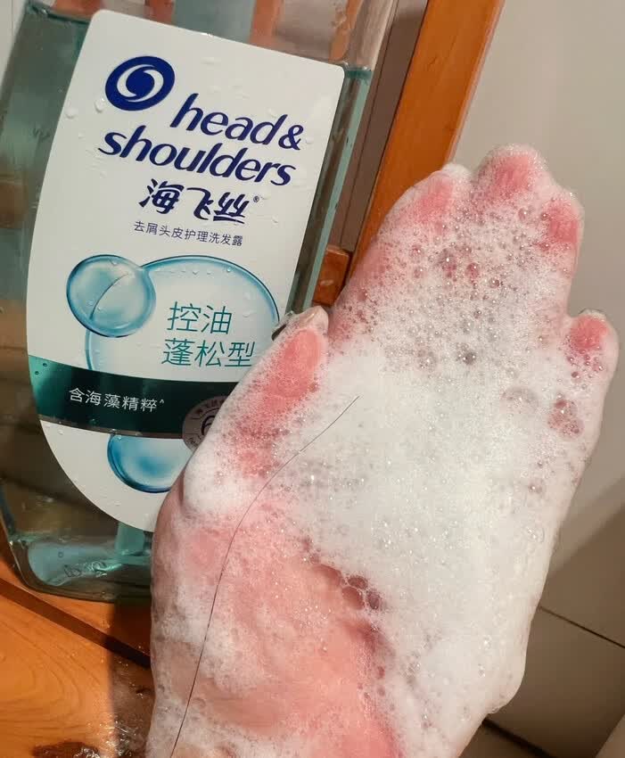 油头星人快看！三天不洗还蓬的快乐🥹