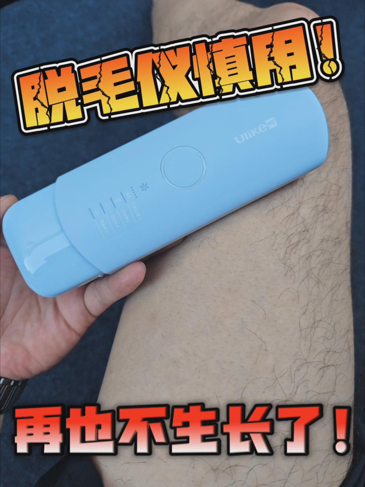 NY|脱毛仪要慎用!以后想长出来都难呀!