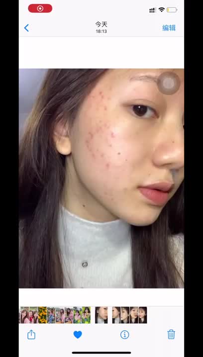 啊啊啊用最快的方法打败痘印暗沉👌|||