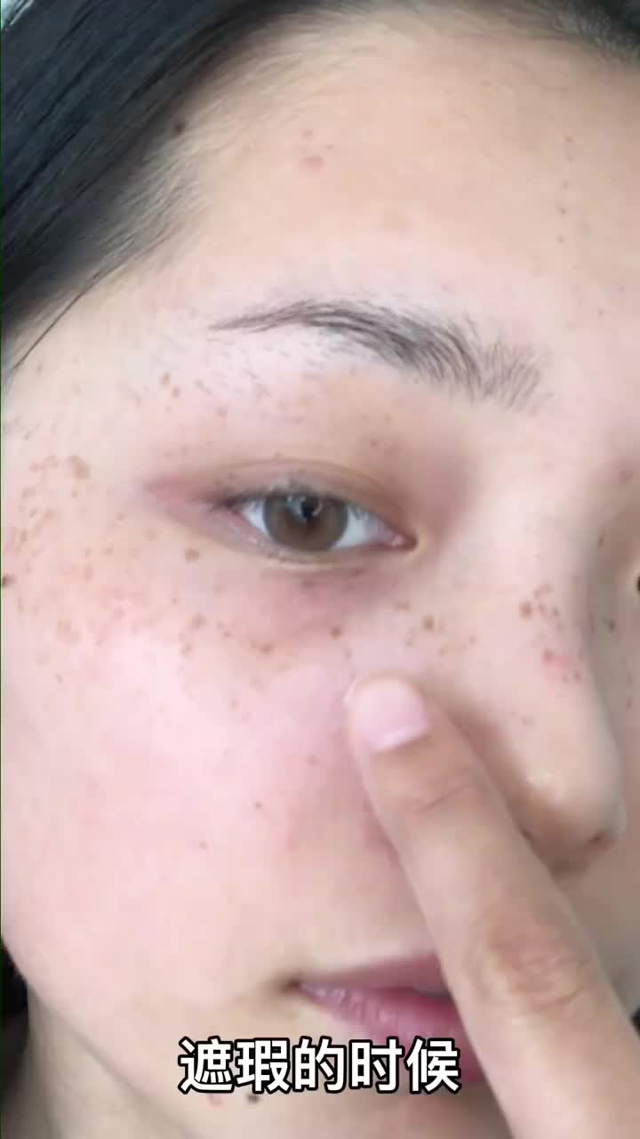 雀斑干皮|拒绝眼下厚重卡纹❗️