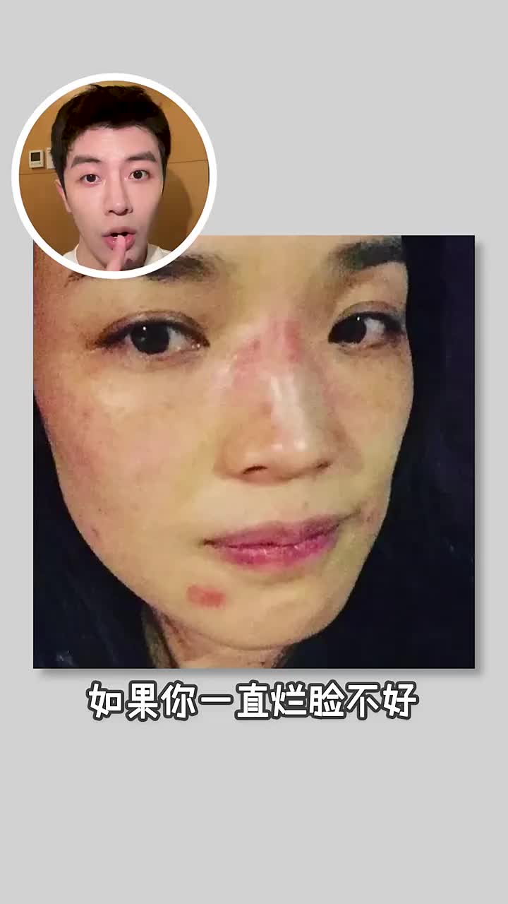烂脸一直不好？原因颠覆你认知！上干货！👊