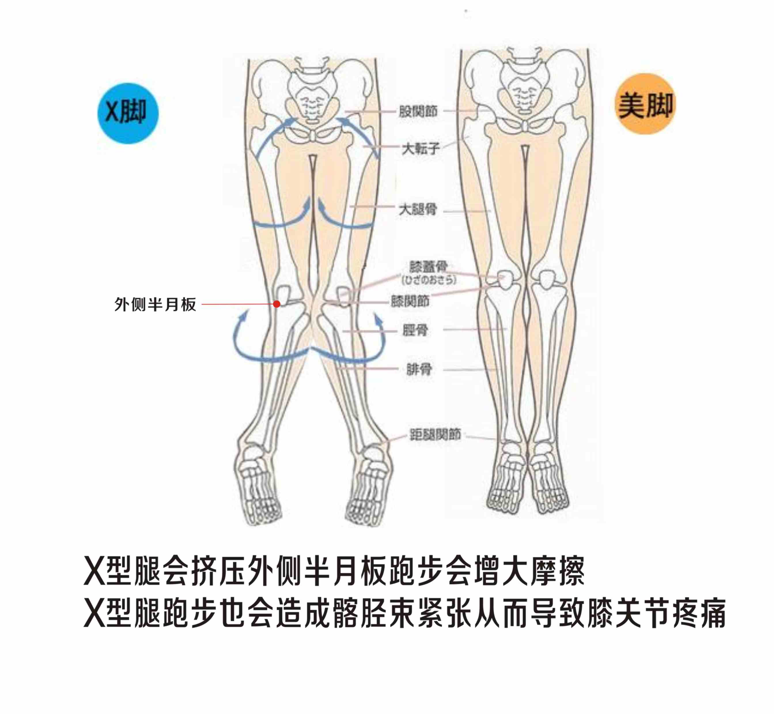 你适合跑步吗?